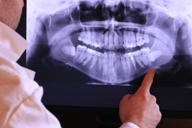 Best Emergency Gum Pain Relief  in Abingdon, IL