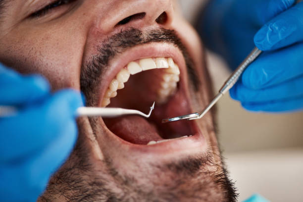 Best Knocked-Out Tooth Emergency  in Abingdon, IL