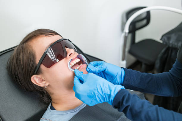 Best Teeth Whitening  in Abingdon, IL